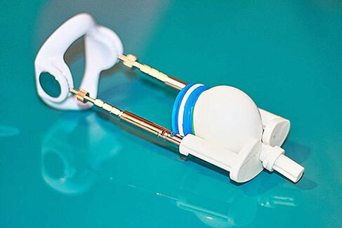 Extender - seade liikme tõhusaks suurendamiseks